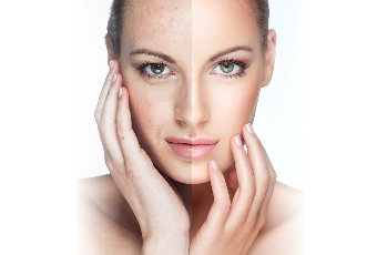 The result of the use of the cream VitalDermax becomes noticeable already after 15 minutes