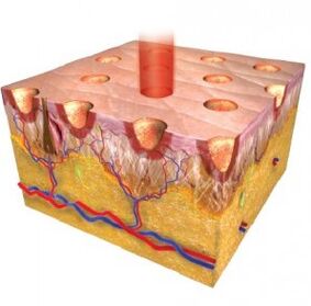 Epidermis