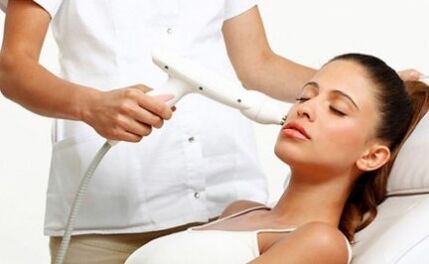 Lasers used for the rejuvenation of the fractional laser