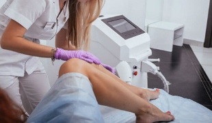 laser hair removal for unwanted body hair