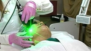 pros and cons of laser facial skin rejuvenation