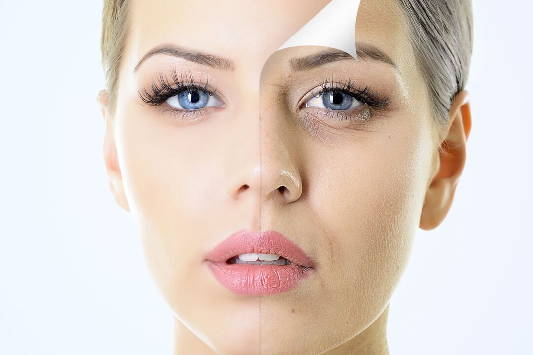 Rejuvenation of the skin