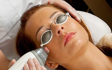 the essence of the procedure of fractional laser skin rejuvenation
